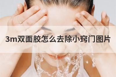 3m双面胶怎么去除小窍门图片
