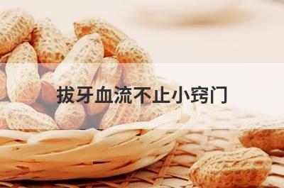 拔牙血流不止小窍门