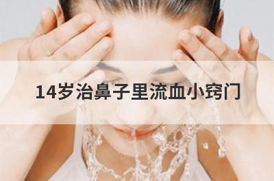 14岁治鼻子里流血小窍门