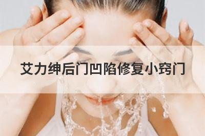 艾力绅后门凹陷修复小窍门