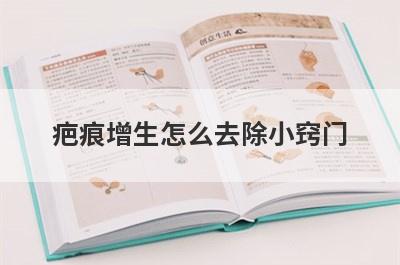疤痕增生怎么去除小窍门