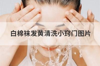 白棉袜发黄清洗小窍门图片