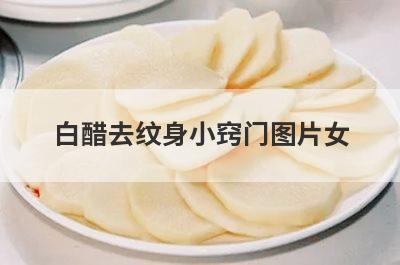 白醋去纹身小窍门图片女