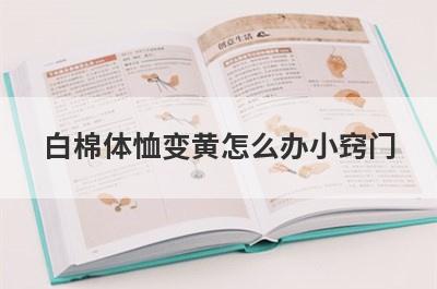 白棉体恤变黄怎么办小窍门