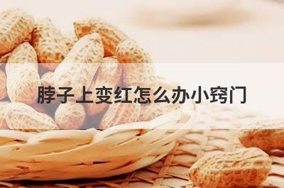 脖子上变红怎么办小窍门
