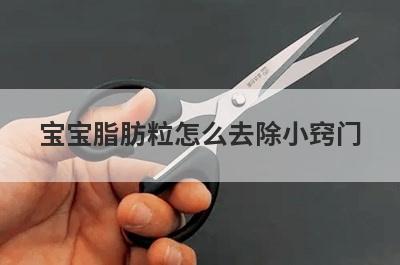 宝宝脂肪粒怎么去除小窍门
