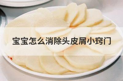 宝宝怎么消除头皮屑小窍门