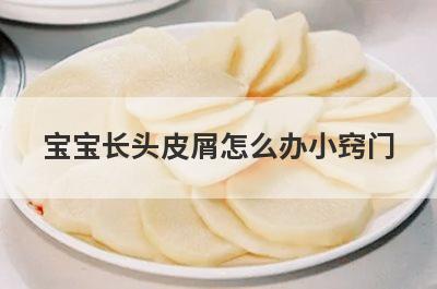 宝宝长头皮屑怎么办小窍门